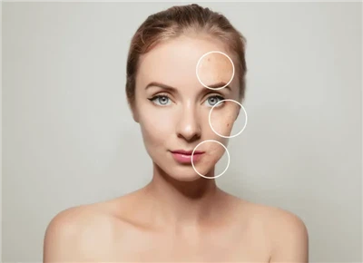 RF Microneedling Vs. Fractional CO2 Laser: Which Skin Resurfacing Treatment I...