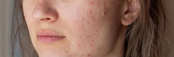 productcate-662-400 productcate-662-400