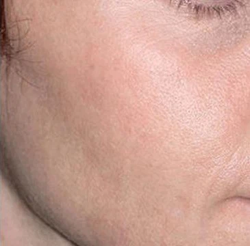 productcate-662-400 productcate-662-400