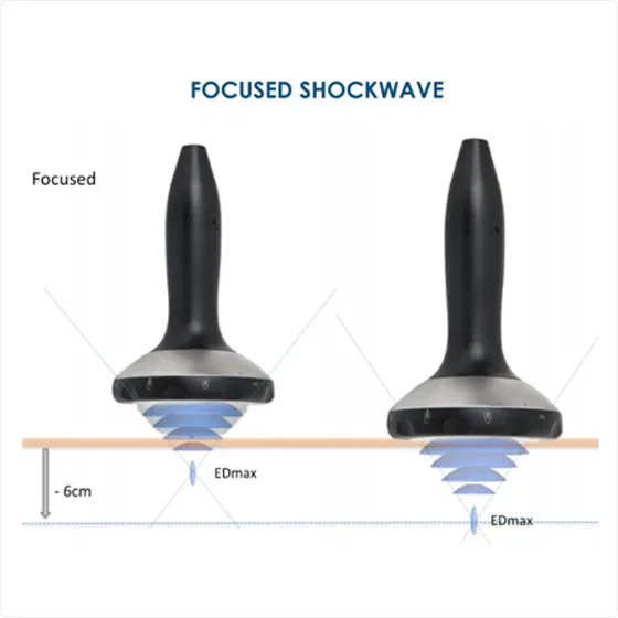 productcate-555-555 Electrohydraulic Acoustic Shockwave