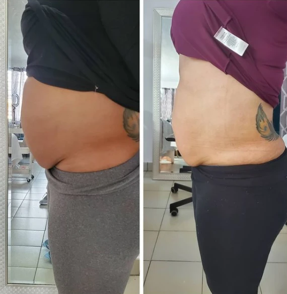 Fat Loss Fat Loss