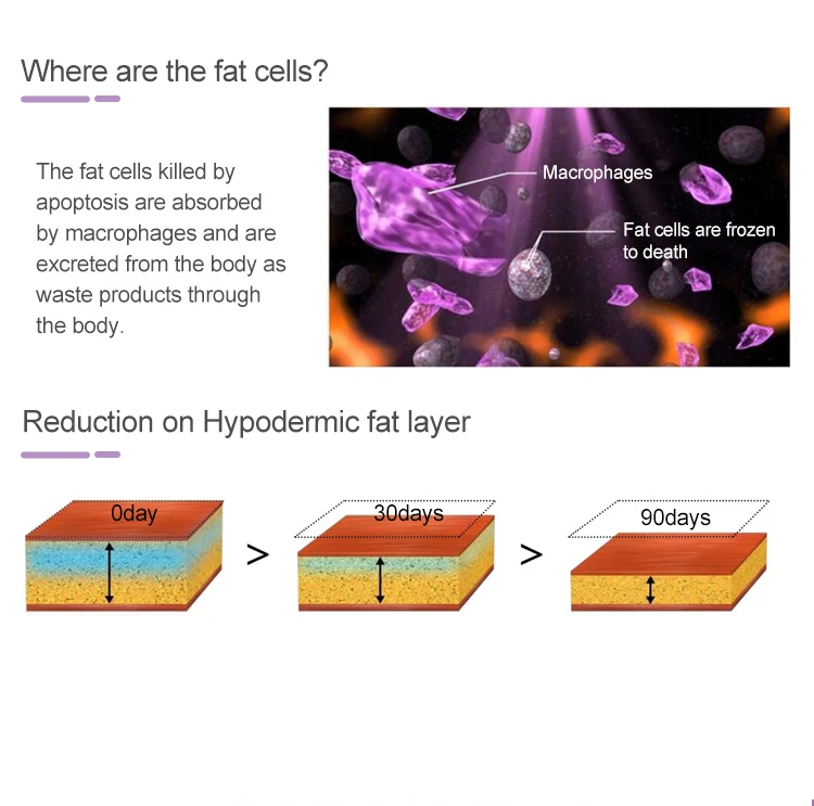 COOLSULPTING TREATMENT COOLSULPTING TREATMENT